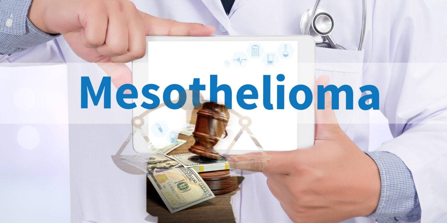 How To Get Mesothelioma Financial Compensation